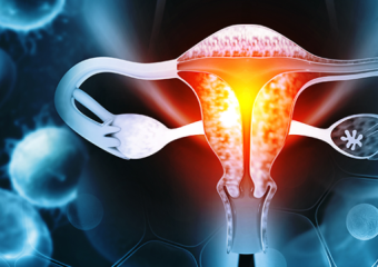Gynecology Services